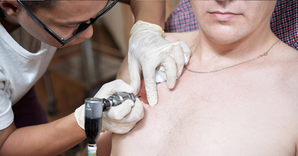 Dad sat through 30 hours of tattoo pain so his son would feel better about birthmark - Featured image