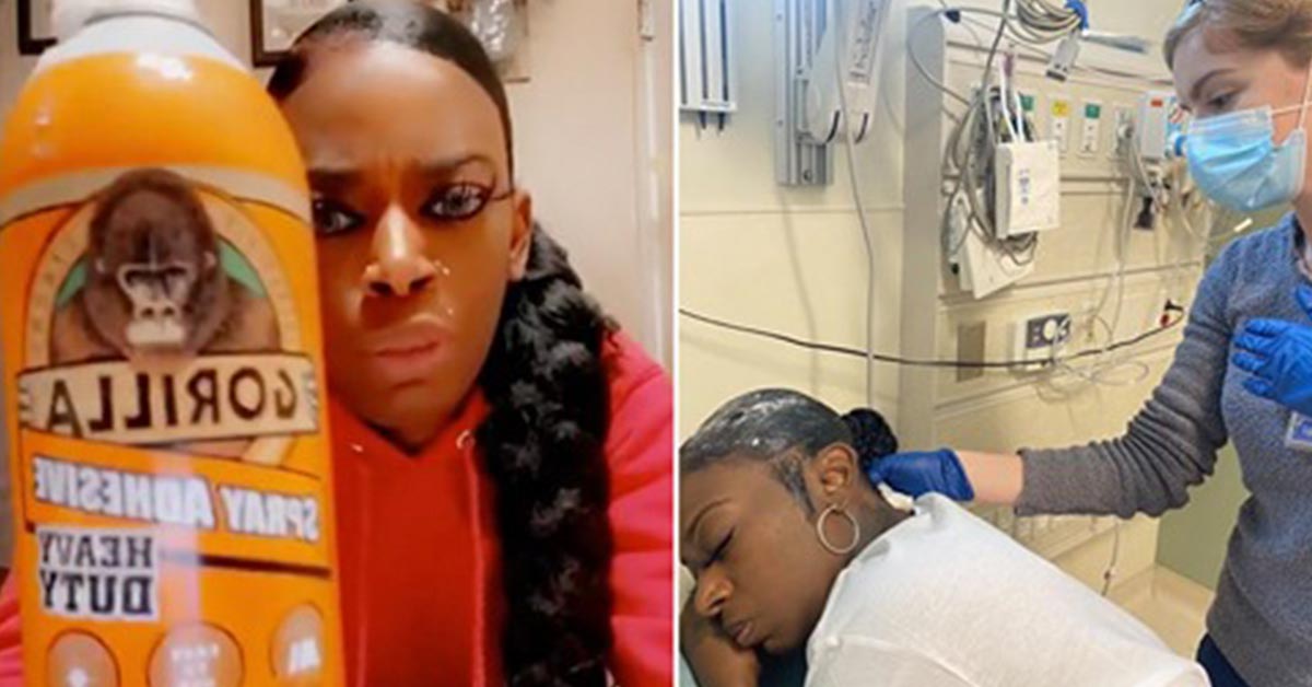 Woman Accidentally Uses Gorilla Glue to Style Her Hair, Goes To