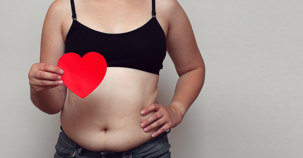 Women Are Posting Unfiltered Pictures To #NormalizeNormalBodies - Featured image