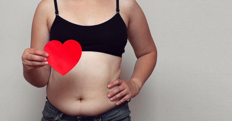 Women Are Posting Unfiltered Pictures To #NormalizeNormalBodies - Featured image