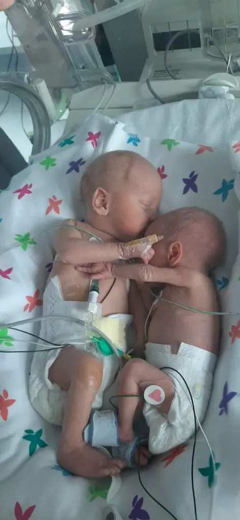 baby girl embracing her twin brother in the hospital. 