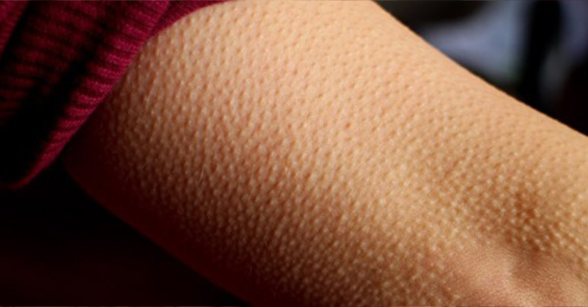 Getting Goosebumps While Listening to Music Means Your Brain Could Be