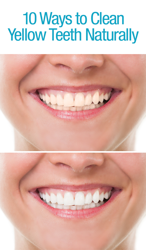5 Ways to Clean Yellow Teeth Naturally Tiffy Taffy