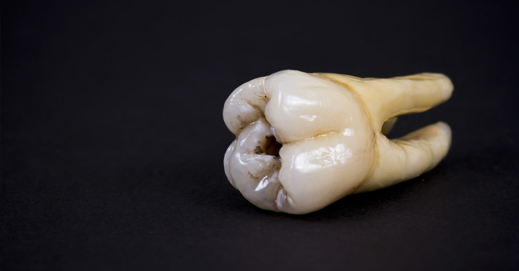 ‘Teeth Nails’ Are The New Fashion Trend And I’m Creeped Out To Say The Least - Featured image