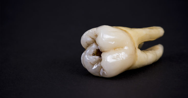 ‘Teeth Nails’ Are The New Fashion Trend And I’m Creeped Out To Say The Least - Featured image