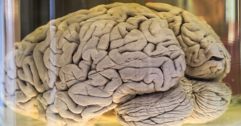 A Never-Before-Seen Type of Signal Has Been Detected in The Human Brain - Featured image