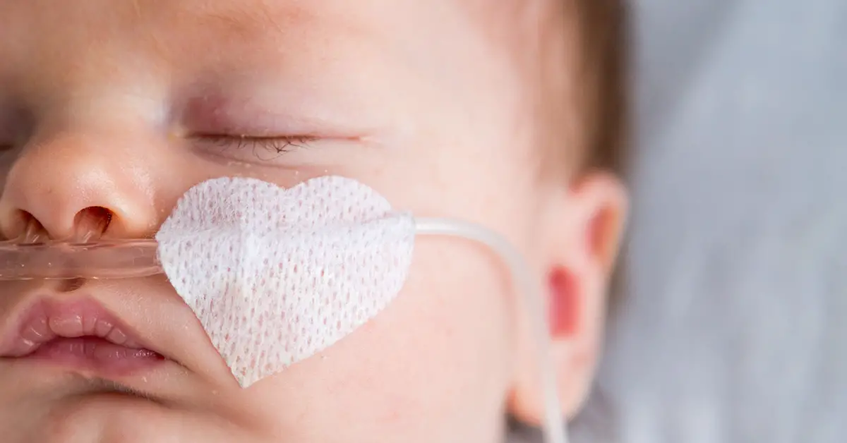 infant with medical tube inserted in nose