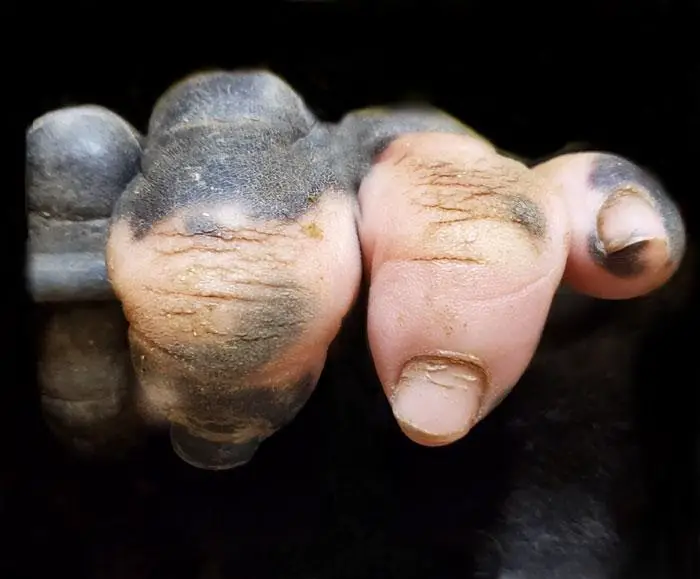 Gorilla hand with vitiligo 