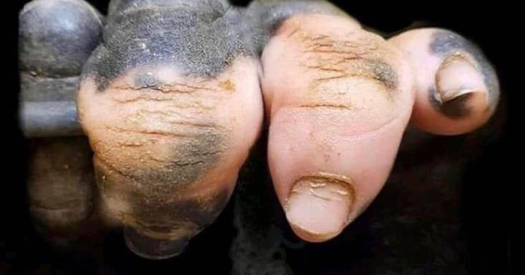 Picture of Gorilla With Hands That Bear An Uncanny Resemblance To Human Hands Due To A Lack Of Pigmentation Goes Viral - Featured image