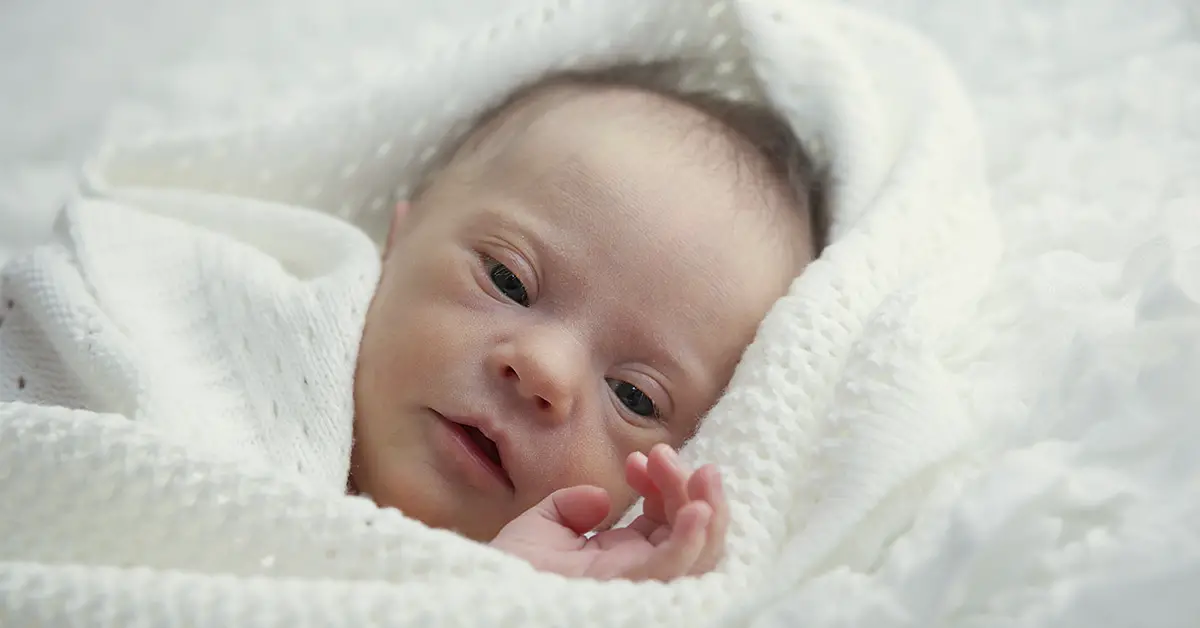 baby with down syndrome laying in white bedding