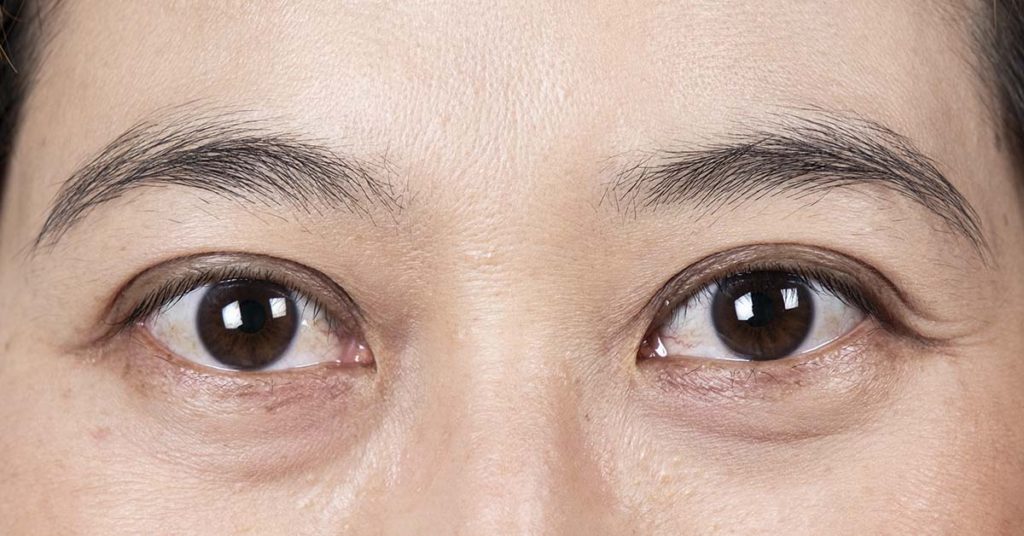 The eye test: Some say it’s hard, some say it’s easy. I did it with my eyes closed. - Featured image