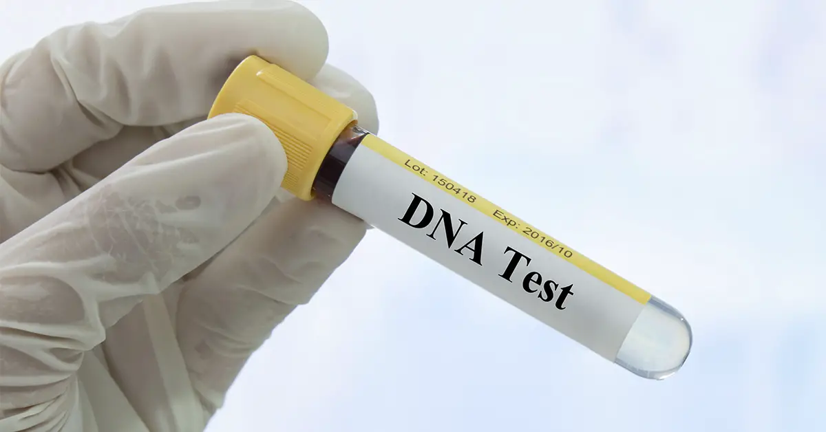 hand wearing latex glove holding vile labelled "DNA Test"