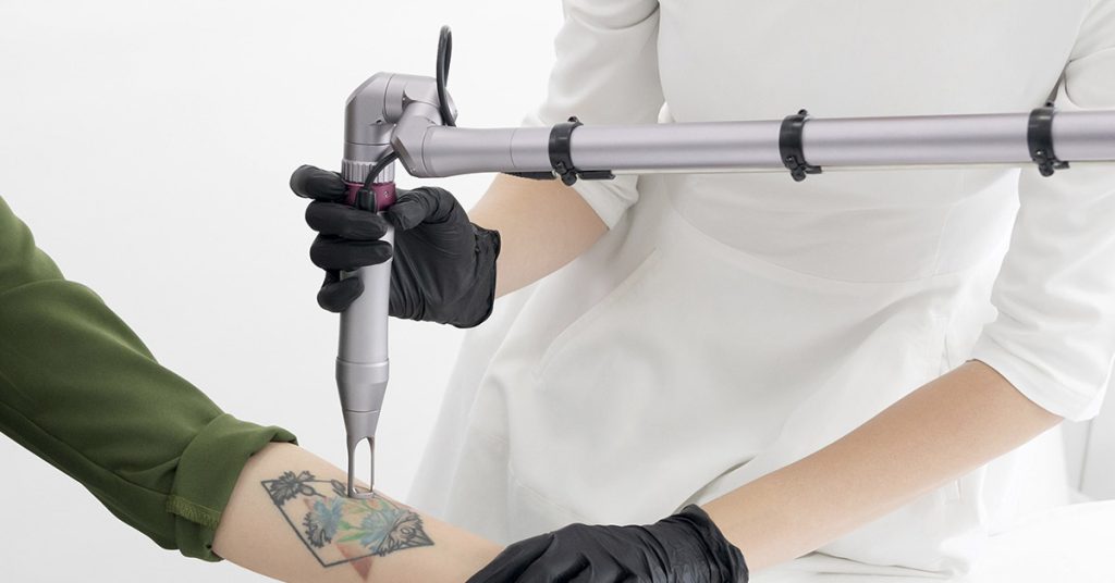 London Tattoo Removal Studio Offering to Remove Kanye West Tattoos For Free - Featured image