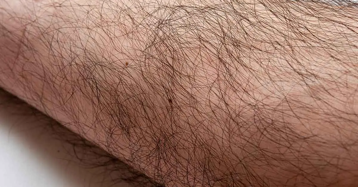 hairy arm