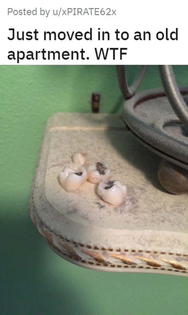 Several teeth on a basin.
