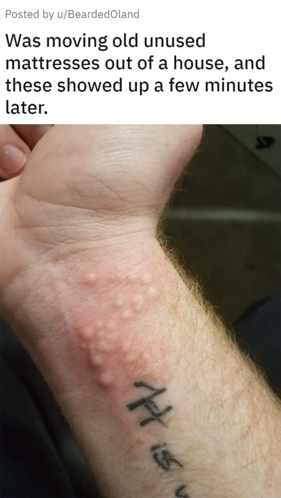 Strange objects 3: Disturbing blisters on the skin