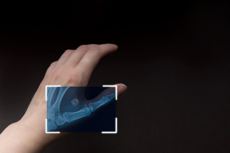Hand Upgrades in Sweden: Impressive Yet a Bit Unnerving - Featured image